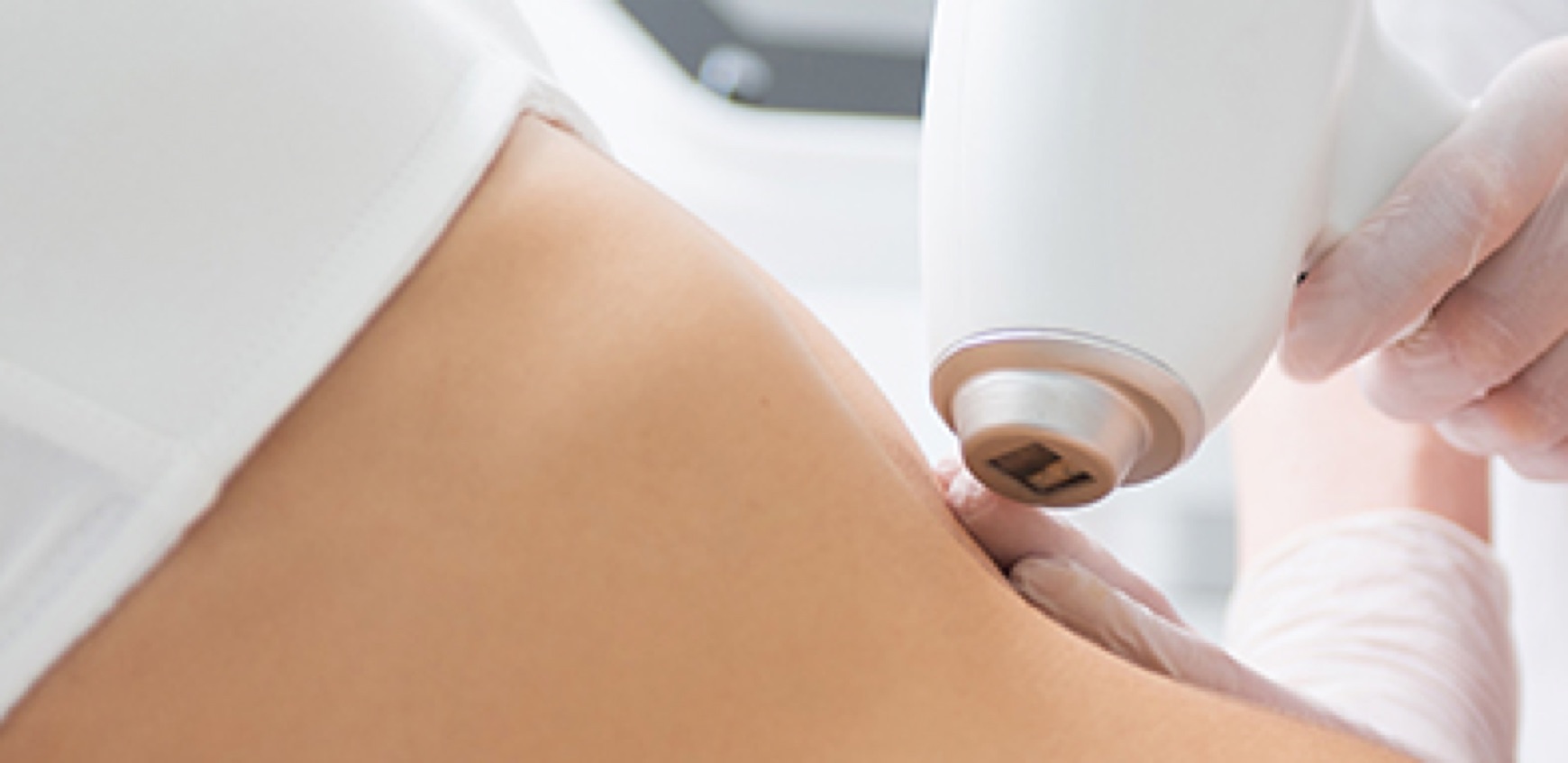 aplicación body contouring a una paciente
